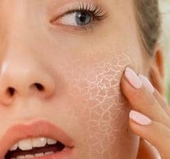 dry skin causes treatment