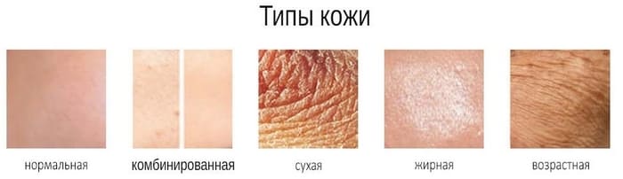Facial skin type