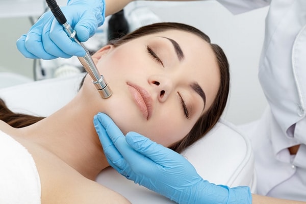 Microdermabrasion removal of age spots