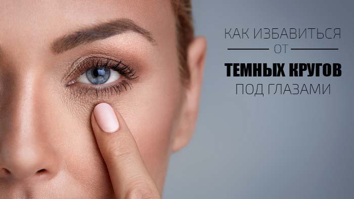 dark circles under eyes causes in women