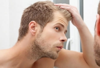 Methods for dealing with hair loss
